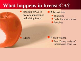 What happens in breast CA? Fixation of CA to pectoral muscles or underlying fascia Edema △   breast skin Thickening Scaly skin around nipple Dimpling  △   skin texture Peau d’orange—sign of inflammatory breast CA 