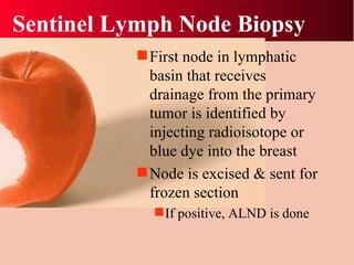 Sentinel Lymph Node Biopsy First node in lymphatic basin that receives drainage from the primary tumor is identified by injecting radioisotope or blue dye into the breast Node is excised & sent for frozen section  If positive, ALND is done 