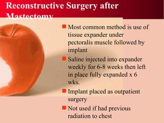 Reconstructive Surgery after Mastectomy Most common method is use of tissue expander under pectoralis muscle followed by implant Saline injected into expander weekly for 6-8 weeks then left in place fully expanded x 6 wks. Implant placed as outpatient surgery Not used if had previous radiation to chest 