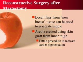 Reconstructive Surgery after Mastectomy Local flaps from “new breast” tissue can be used to re-create nipple Areola created using skin graft from inner thigh Tattoo procedure to recreate darker pigmentation 