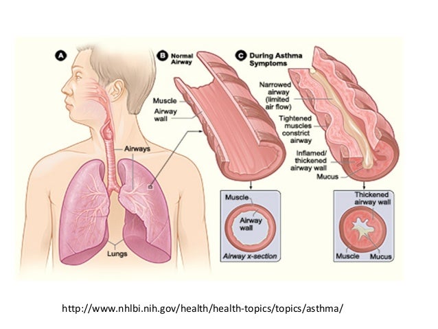 NRSG351 Respiratory Agents in Asthma, COPD, Cough, Cold 
