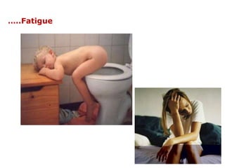 …..Fatigue
 