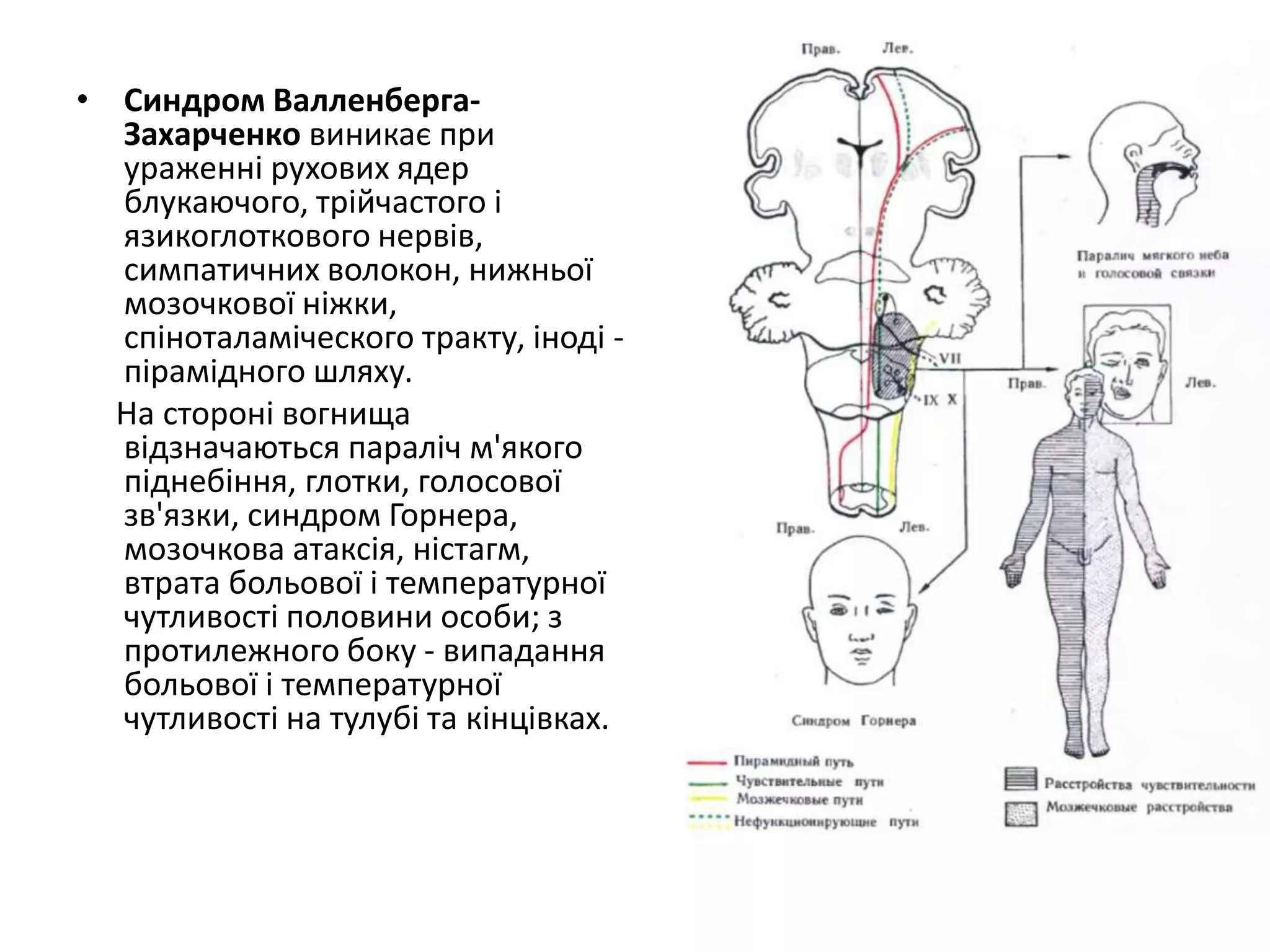 блукаючий нерв | PPT
