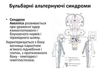 Бульбарні альтернуючі синдроми
• Синдром
Авелліса розвивається
при ураженні ядер
язикоглоткового і
блукаючого нервів і
пірамідного шляху.
Характеризується з боку
вогнища паралічем
м'якого піднебіння і
глотки, з протилежного
боку - геміпарез і
гемігіпестезією.
 