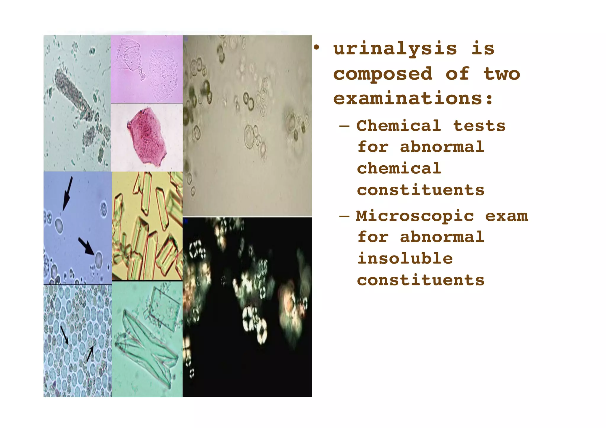 •  urinalysis is
   composed of two
   examinations:
  –  Chemical tests
     for abnormal
     chemical
     constituents       
  –  Microscopic exam
     for abnormal
     insoluble
     constituents 
 
