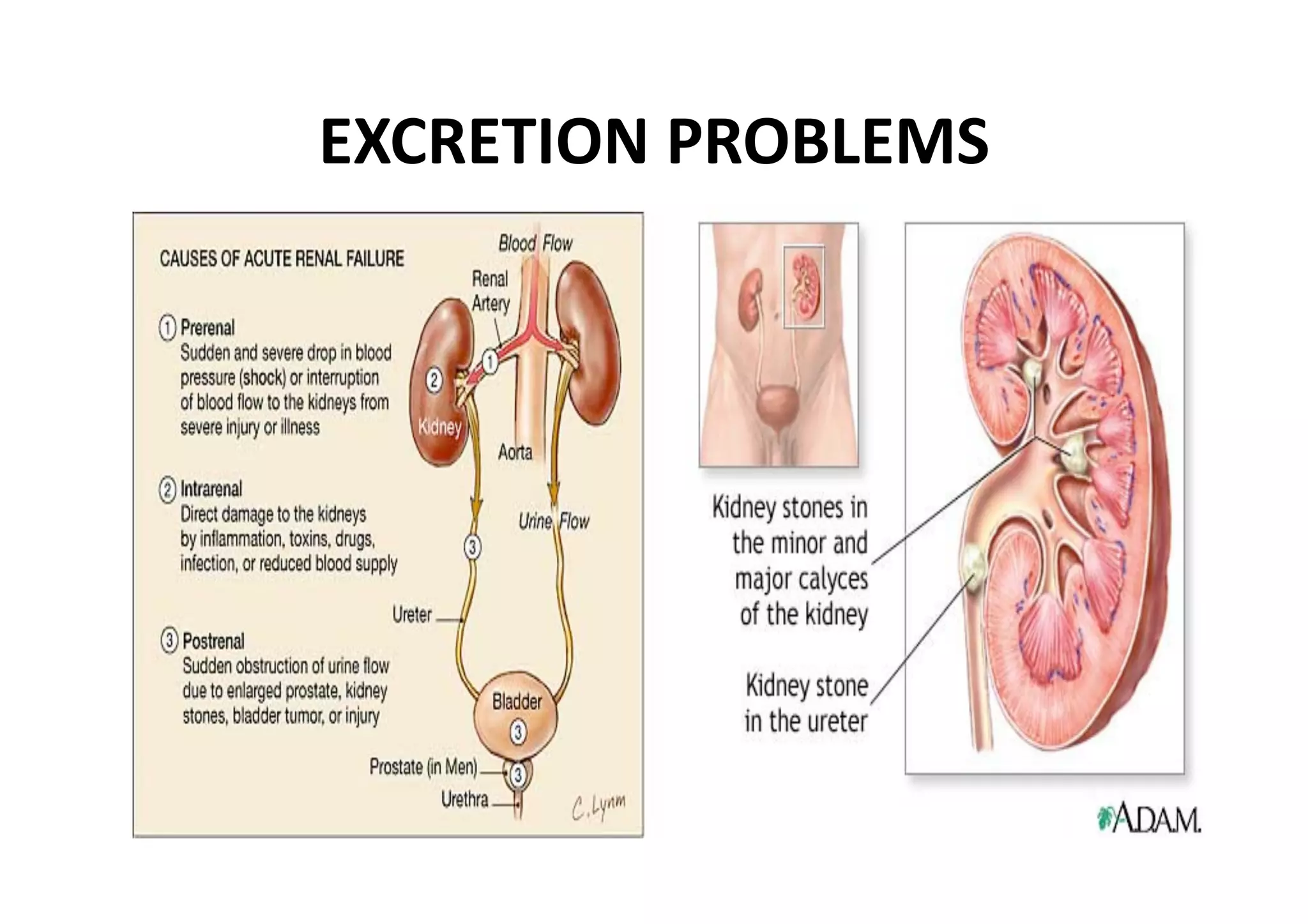 EXCRETION PROBLEMS 
 