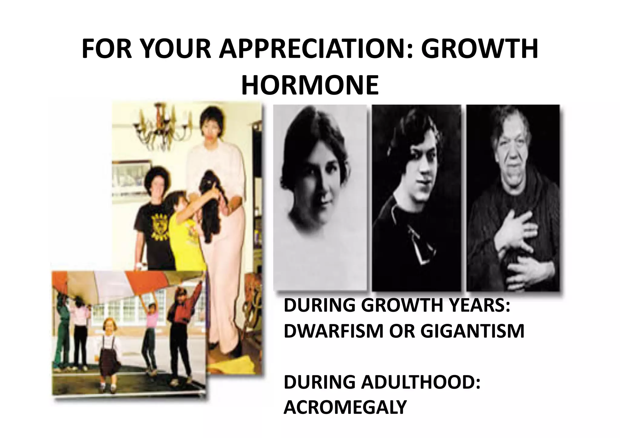 FOR YOUR APPRECIATION: GROWTH 
          HORMONE 




             DURING GROWTH YEARS: 
             DWARFISM OR GIGANTISM 

             DURING ADULTHOOD: 
             ACROMEGALY 
 