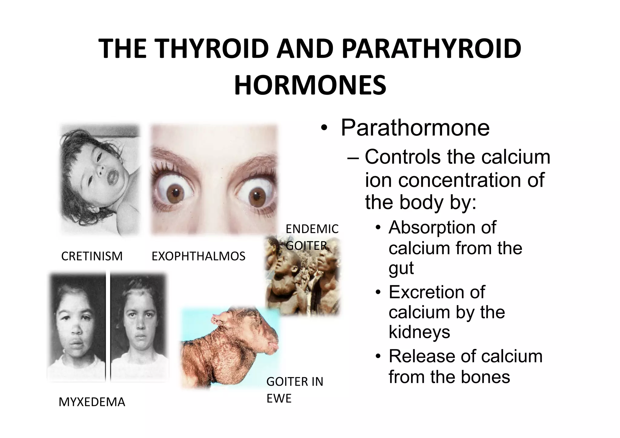 THE THYROID AND PARATHYROID 
              HORMONES 
                                     •  Parathormone
                                           – Controls the calcium
                                             ion concentration of
                                             the body by:
                                ENDEMIC      •  Absorption of
                                GOITER          calcium from the
CRETINISM    EXOPHTHALMOS 
                                                gut
                                             •  Excretion of
                                                calcium by the
                                                kidneys
                                             •  Release of calcium
                             GOITER IN          from the bones 
MYXEDEMA                     EWE 
 