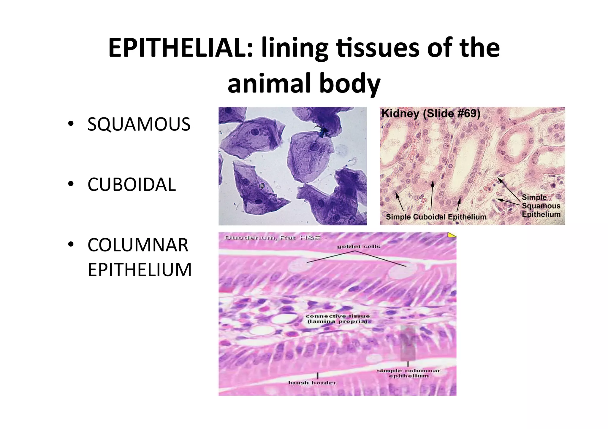 EPITHELIAL: lining _ssues of the 
             animal body 
•  SQUAMOUS 

•  CUBOIDAL 

•  COLUMNAR 
   EPITHELIUM 
 
