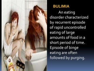 BULIMIA
An eating
disorder characterized
by recurrent episode
of rapid uncontrolled
eating of large
amounts of food in a
short period of time.
Episode of binge
eating are often
followed by purging.
 