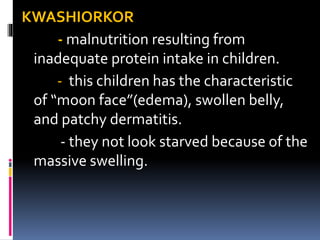KWASHIORKOR
- malnutrition resulting from
inadequate protein intake in children.
- this children has the characteristic
of “moon face”(edema), swollen belly,
and patchy dermatitis.
- they not look starved because of the
massive swelling.
 