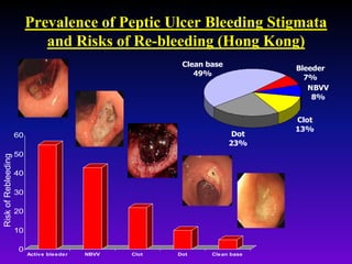 Dot
23%
Clot
13%
Bleeder
7%
NBVV
8%
Clean base
49%
Prevalence of Peptic Ulcer Bleeding Stigmata
and Risks of Re-bleeding (Hong Kong)
0
10
20
30
40
50
60
Active bleeder NBVV Clot Dot Clean base
RiskofRebleeding
 