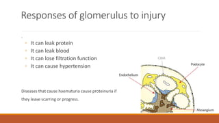 Responses of glomerulus to injury
.
◦ It can leak protein
◦ It can leak blood
◦ It can lose filtration function
◦ It can cause hypertension
Diseases that cause haematuria cause proteinuria if
they leave scarring or progress.
 