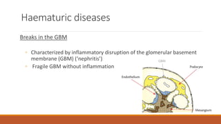 Haematuric diseases
Breaks in the GBM
◦ Characterized by inflammatory disruption of the glomerular basement
membrane (GBM) (‘nephritis’)
◦ Fragile GBM without inflammation
 