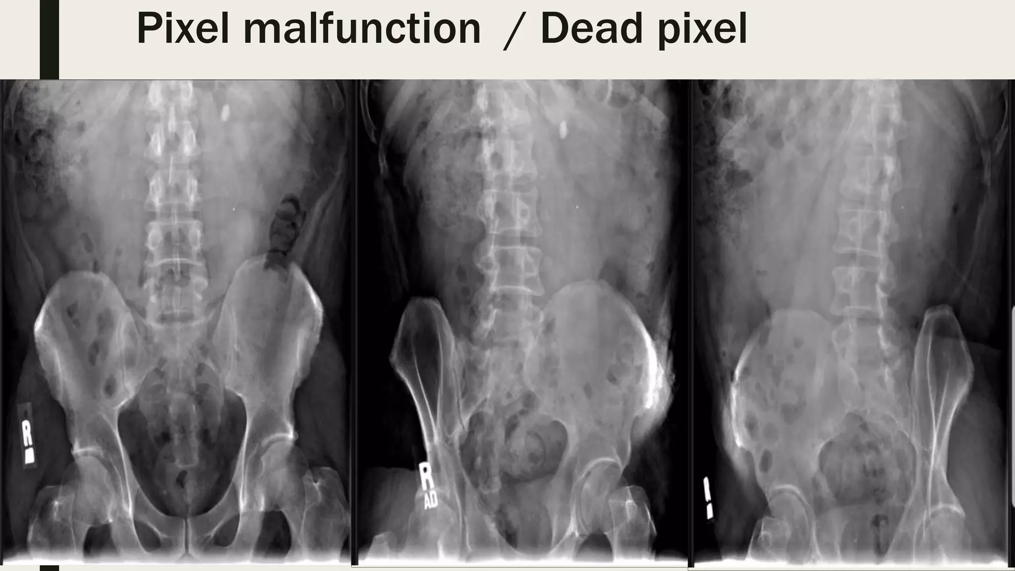 Radiographic screen film artifacts | PPTX