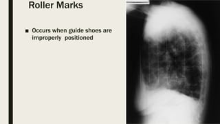 Roller Marks
■ Occurs when guide shoes are
improperly positioned
 