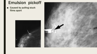 Emulsion pickoff
■ Caused by pulling stuck
films apart
 