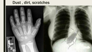 Dust , dirt, scratches
 