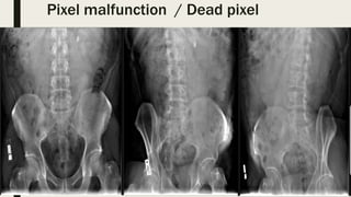 Pixel malfunction / Dead pixel
 