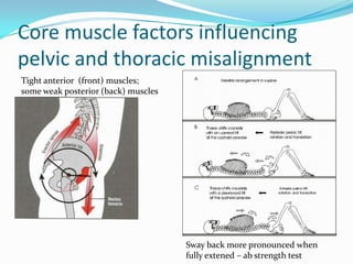 Core muscle factors influencing
pelvic and thoracic misalignment
Tight anterior (front) muscles;
some weak posterior (back) muscles
Sway back more pronounced when
fully extened – ab strength test
 