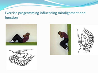 Exercise programming influencing misalignment and
function
 