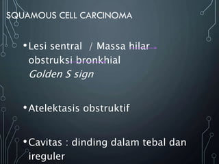 •Lesi sentral / Massa hilar
obstruksi bronkhial
Golden S sign
•Atelektasis obstruktif
•Cavitas : dinding dalam tebal dan
ireguler
 