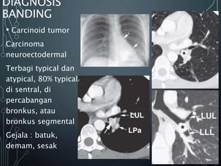 DIAGNOSIS
BANDING
• Carcinoid tumor
Carcinoma
neuroectodermal
Terbagi typical dan
atypical, 80% typical
di sentral, di
percabangan
bronkus, atau
bronkus segmental
Gejala : batuk,
demam, sesak
 
