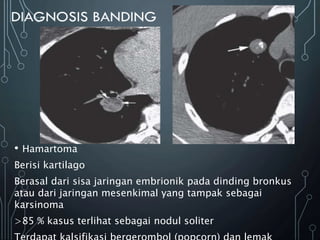 • Hamartoma
Berisi kartilago
Berasal dari sisa jaringan embrionik pada dinding bronkus
atau dari jaringan mesenkimal yang tampak sebagai
karsinoma
>85 % kasus terlihat sebagai nodul soliter
 