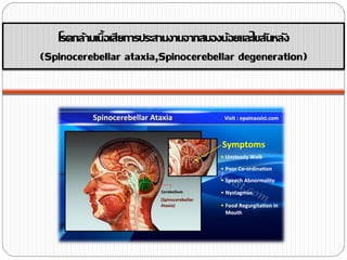 โรคกล้ามเนื้อเสียการประสานงานจากสมองน้อยและไขสันหลัง
(Spinocerebellar ataxia,Spinocerebellar degeneration)
 