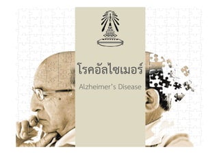 โรคอัลไซเมอรโรคอัลไซเมอร
Alzheimer’s Disease
 