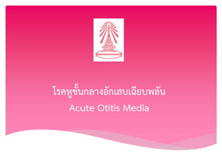 โรคหูชั้นกลางอักเสบเฉียบพลัน
Acute Otitis Media
 