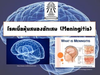 โรคเยื่อหุ้มสมองอักเสบ (Meningitis)
http://www.creditonhand.com
https://www.slideshare.net/MedicalTerminology1/what-is-
meningitis-n
 