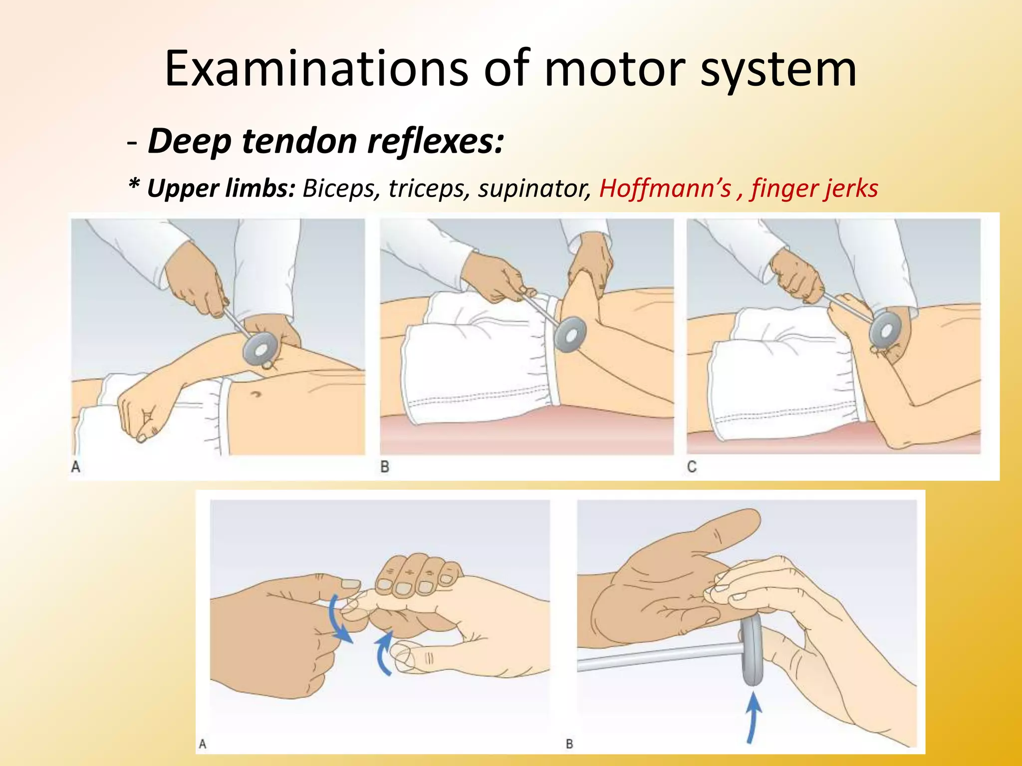 Examinations of motor system
- Deep tendon reflexes:
* Upper limbs: Biceps, triceps, supinator, Hoffmann’s , finger jerks
 