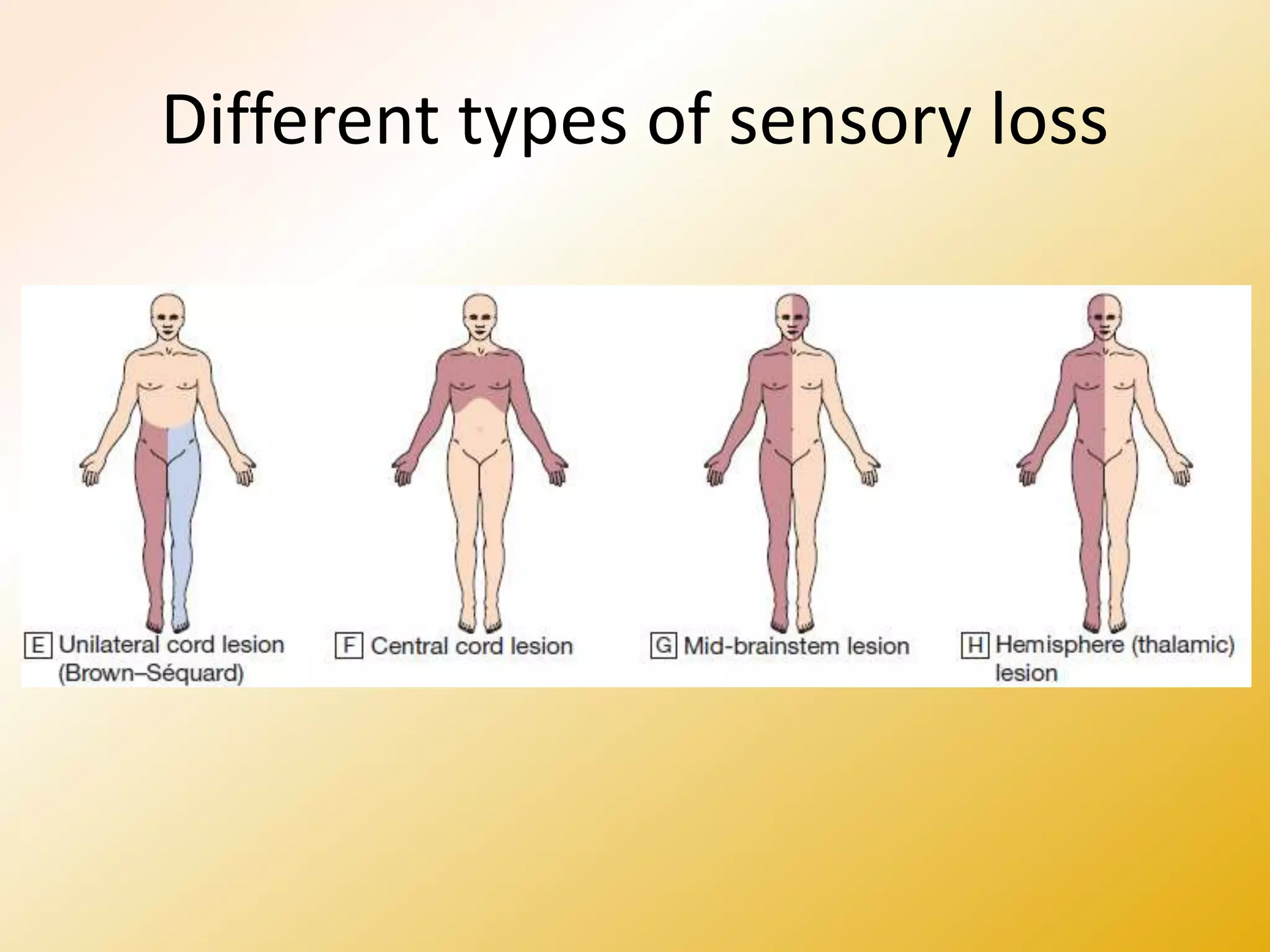 Different types of sensory loss
 