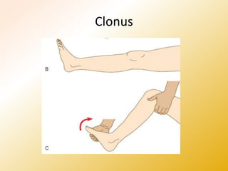 Neurological System Examination. Khan MS | PPTX