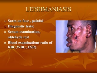 LEISHMANIASIS
 Sores on face , painful
 Diagnostic tests:
 Serum examination,
aldehyde test
 Blood examination( ratio of
RBC,WBC, ESR)
 