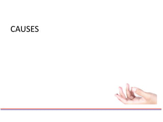 CAUSES
 