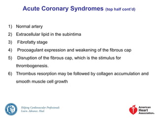 Acute Coronary Syndromes (top half cont’d)
1) Normal artery
2) Extracellular lipid in the subintima
3) Fibrofatty stage
4) Procoagulant expression and weakening of the fibrous cap
5) Disruption of the fibrous cap, which is the stimulus for
thrombogenesis.
6) Thrombus resorption may be followed by collagen accumulation and
smooth muscle cell growth
 