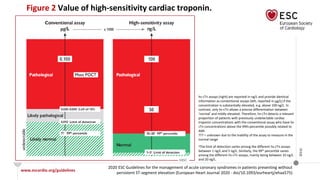 www.escardio.org/guidelines
2020 ESC Guidelines for the management of acute coronary syndromes in patients presenting without
persistent ST-segment elevation (European Heart Journal 2020 - doi/10.1093/eurheartj/ehaa575)
©ESC
Figure 2 Value of high-sensitivity cardiac troponin.
aThe limit of detection varies among the different hs-cTn assays
between 1 ng/L and 5 ng/L. Similarly, the 99th percentile varies
among the different hs-cTn assays, mainly being between 10 ng/L
and 20 ng/L.
hs-cTn assays (right) are reported in ng/L and provide identical
information as conventional assays (left, reported in μg/L) if the
concentration is substantially elevated, e.g. above 100 ng/L. In
contrast, only hs-cTn allows a precise differentiation between
‘normal’ and mildly elevated. Therefore, hs-cTn detects a relevant
proportion of patients with previously undetectable cardiac
troponin concentrations with the conventional assay who have hs-
cTn concentrations above the 99th percentile possibly related to
AMI.
??? = unknown due to the inability of the assay to measure in the
normal range
 