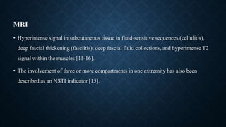 NSTI.pptx