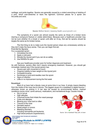 Page 45 of 76
ILOILO SCIENCE AND TECHNOLOGY UNIVERSITY
LEON CAMPUS
Leon, Iloilo
Compiled and outlined by: Camatison,G.
Contributors: Camatison,G, Tacardon, M.F., Aligaen, Q.Jr., & Jaurigue, J.
cartilage, and joints together. Sprains are generally caused by a violent wrenching or twisting of
a joint, which over-stretches or tears the ligament. Common places for a sprain are
the ankle and wrist.
Source: Midfoot Sprain | Upswing Health upswinghealth.com
The symptoms of a sprain are almost exactly the same as those of a broken bone
(barring a compound fracture or visible deformities). Because even a healthcare provider may
not be sure whether it's a break or sprain until after an X-ray, first aid for sprains should be
largely the same as for broken bones.
The first thing to do is make sure the injured person stops any unnecessary activity so
they don't make the injury worse. Then you can begin first aid.
First Aid for Sprains
For a suspected sprain:
1. Immobilize the limb
2. Apply a cold pack
3. Elevate the injured part if you can do so safely
4. Use NSAIDs for pain
See your healthcare provider soon for further diagnosis and treatment.
As with fractures, sprains often don't require emergency treatment. However, you should get
immediate medical care if the injured person has:
 Severe pain with movement or touch
 Ongoing inability to bear weight on the injured joint
 Increased bruising
 Numbness or pins-and-needles near the sprain
 Signs of infection
 Little or no improvement during the first week
Nosebleed
Most of us have had a bloody nose at some time in our lives. It simply means bleeding
from the inside of the nose due to trauma. The biggest cause of a nosebleed is digital trauma—
otherwise known as picking it. It can also be caused by environmental factors, medical
conditions (some minor, some serious), medications, and recreational drugs. Causes include:
 Dry or hot air
 High altitudes
 Chemical fumes that irritate the nasal passage
 Colds and allergies
 Blowing your nose hard or often
 Trauma to the nose
 Deviated septum
 Nasal polyps or tumors
 Bleeding disorders,
including hemophilia and leukemia
 High blood pressure (hypertension)
Source: Got a nosebleed? Stay calm, sit down
scmp.com
Source: Got a nosebleed? Stay calm, sit down
scmp.com
 