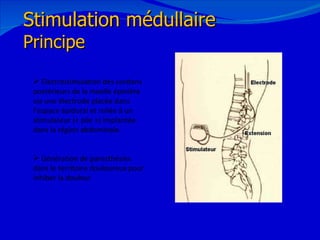 12/08/11 Stimulation médullaire Principe Electrostimulation des cordons postérieurs de la moelle épinière via une électrode placée dans l’espace épidural et reliée à un stimulateur (« pile ») implantée dans la région abdominale. Génération de paresthésies dans le territoire douloureux pour inhiber la douleur 