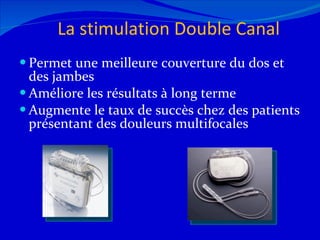 La stimulation Double Canal Permet une meilleure couverture du dos et des jambes Améliore les résultats à long terme Augmente le taux de succès chez des patients présentant des douleurs multifocales 12/08/11 