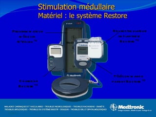 12/08/11 Stimulation médullaire Matériel : le système Restore Programmateur médecin N’Vision™ Neurostimulateur implantable Restore™ Télécommande patient Restore™  Chargeur Restore™ 