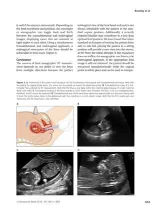 Bromley et al




ly well if the uterus is retroverted). Depending on                 midsagittal view of the fetal head a...