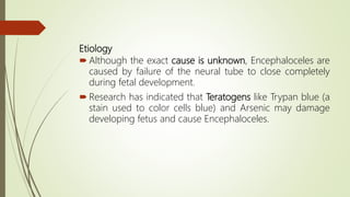 Neural tube defects - in neonates and children | PDF