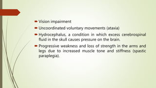 Neural tube defects - in neonates and children | PDF