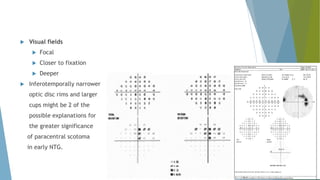  Visual fields
 Focal
 Closer to fixation
 Deeper
 Inferotemporally narrower
optic disc rims and larger
cups might be 2 of the
possible explanations for
the greater significance
of paracentral scotoma
in early NTG.
 