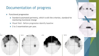 Documentation of progress
 Functional progression
 Standard automated perimetry, which is still the criterion, standard for
monitoring functional change
 Visual field - Before progression identify baseline
 2 to 3 examinations per year.
 