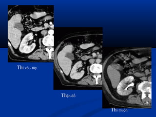 Thận đồ
Thì muộn
Thì vỏ - tủy
 